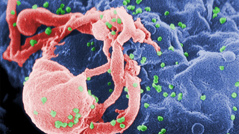 Scanning electron micrograph of HIV-1 budding (in green) from cultured lymphocyte. (Photo: MGN Online/CDC)