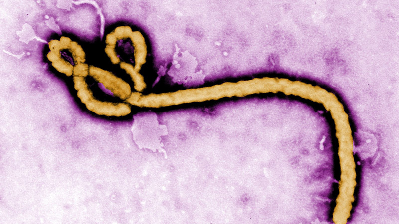 Ebola virus