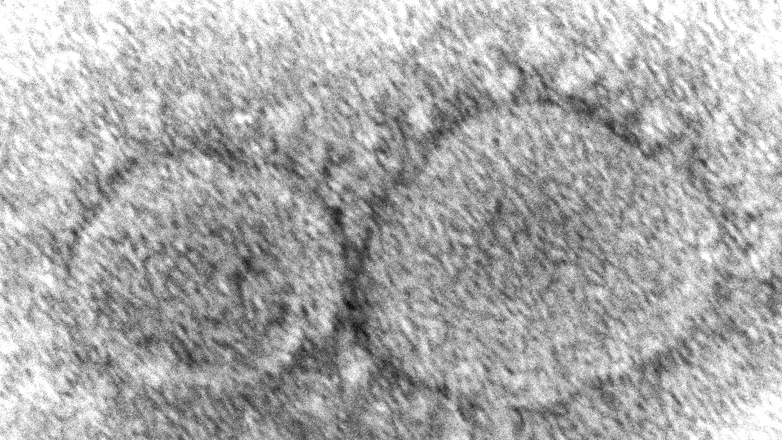 Electron microscope image of SARS-CoV-2 virus particles