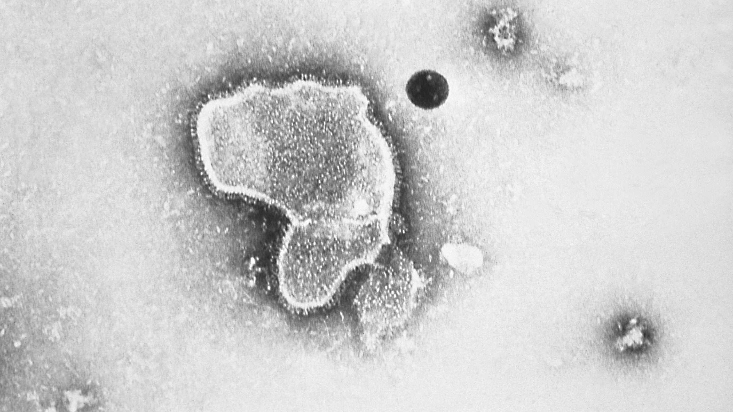 an electron micrograph of Respiratory Syncytial Virus