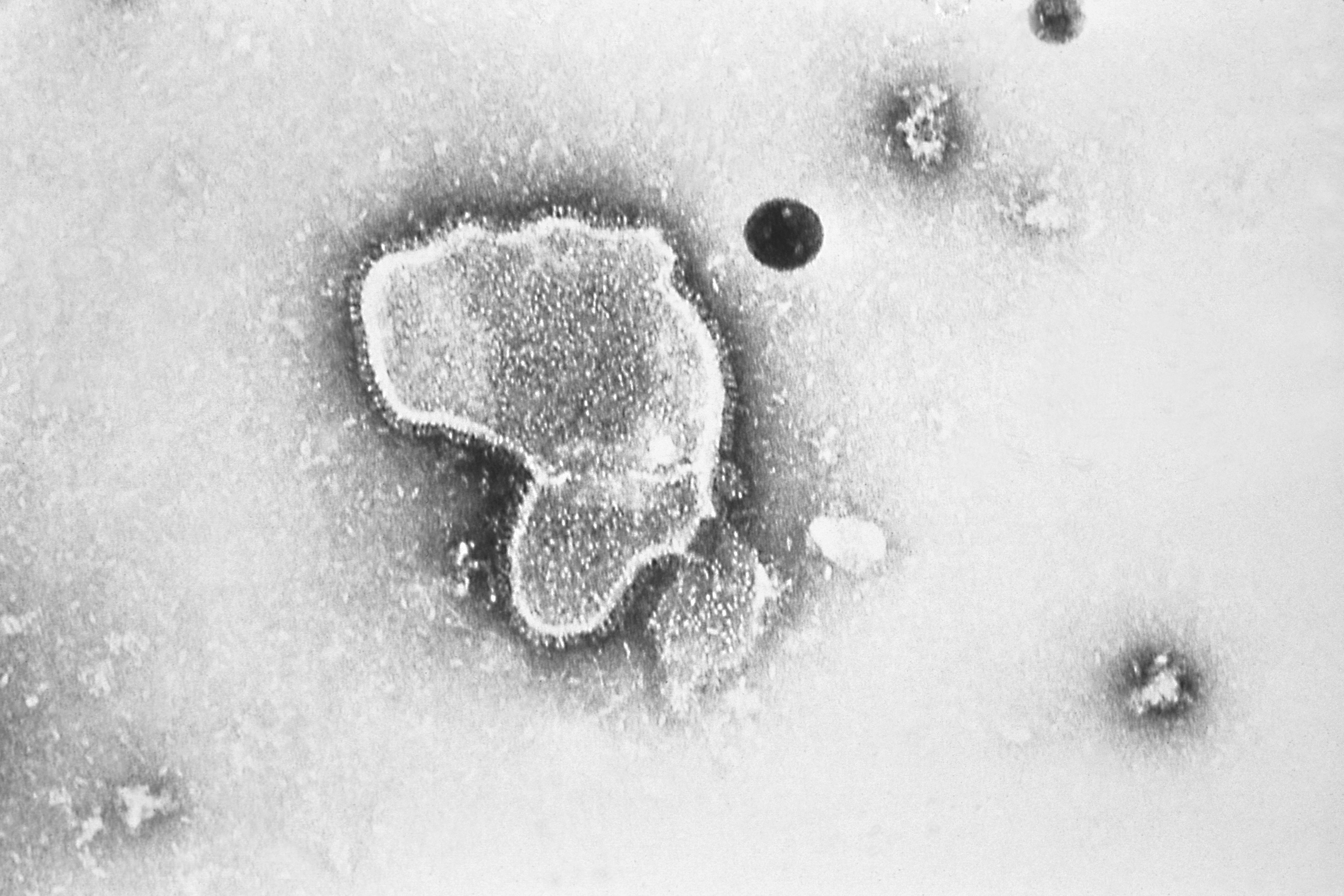 an electron micrograph of Respiratory Syncytial Virus