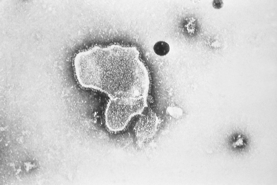 an electron micrograph of Respiratory Syncytial Virus