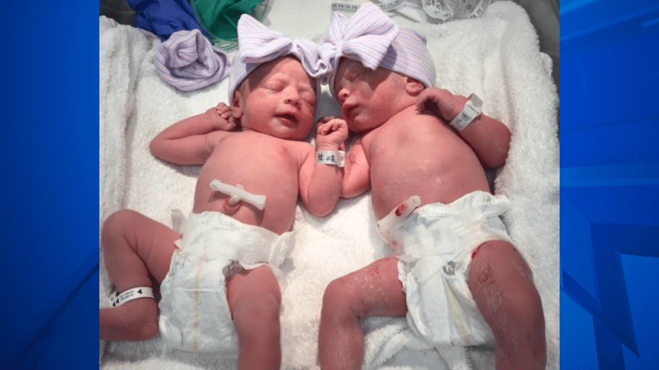 TWINS! Meet Julia and Emma who were recently born at the Cath Lab Director at Rose Medical Center.