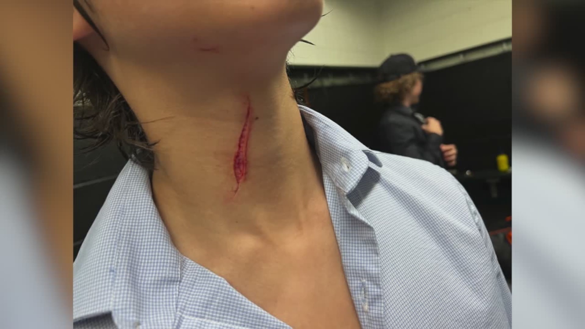 Teen's neck sliced by hockey skate