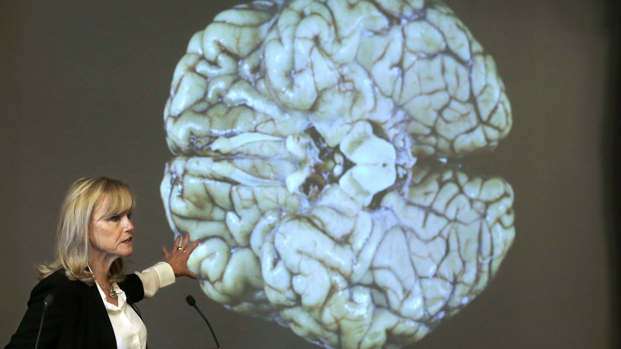 Woman presents as Aaron Hernandez's brain is projected on a screen