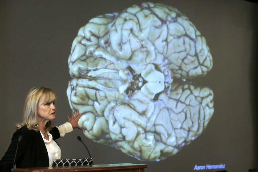 Woman presents as Aaron Hernandez's brain is projected on a screen