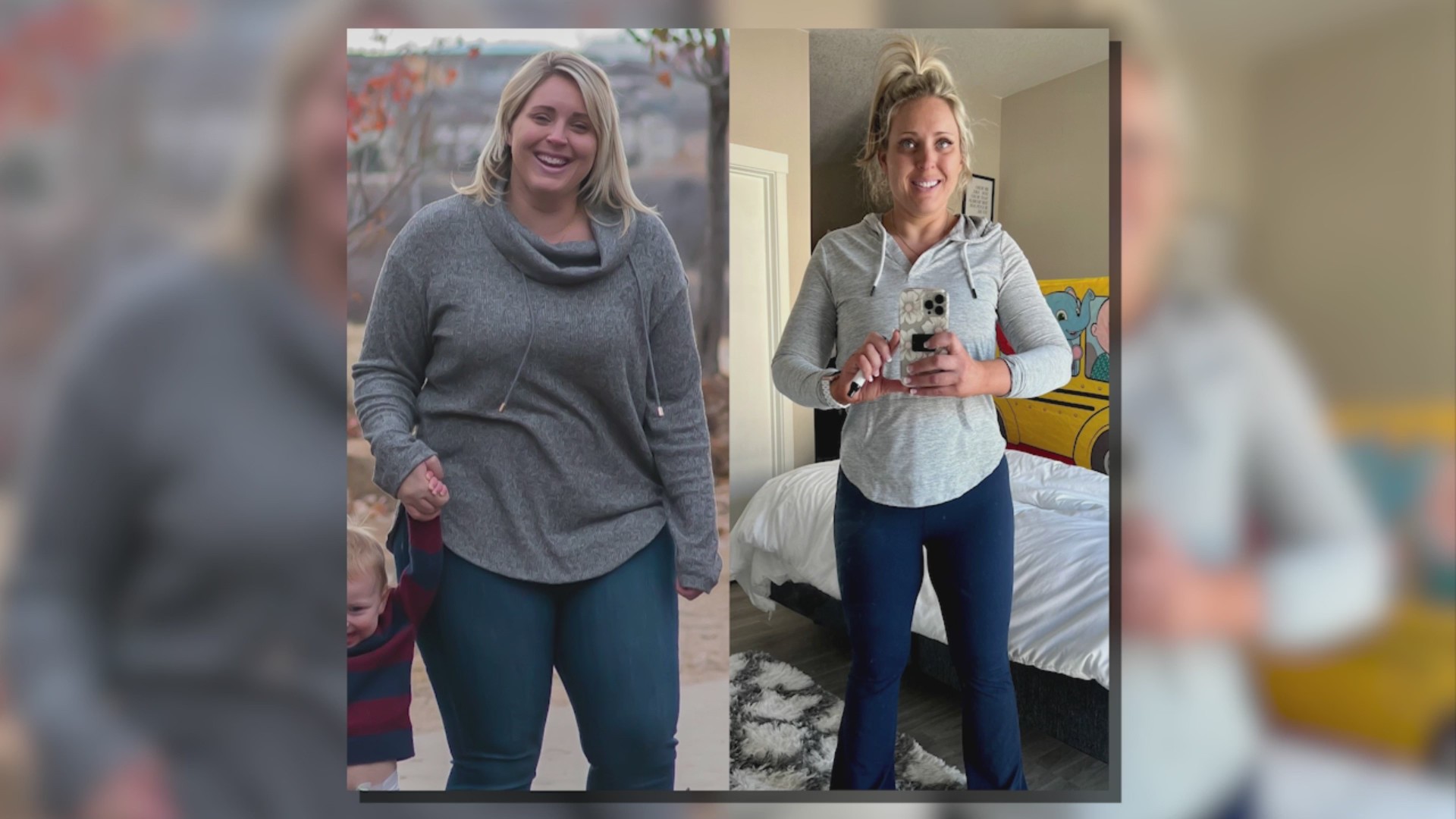 Before and after photos of Lindsey Gyger, who underwent bariatric surgery