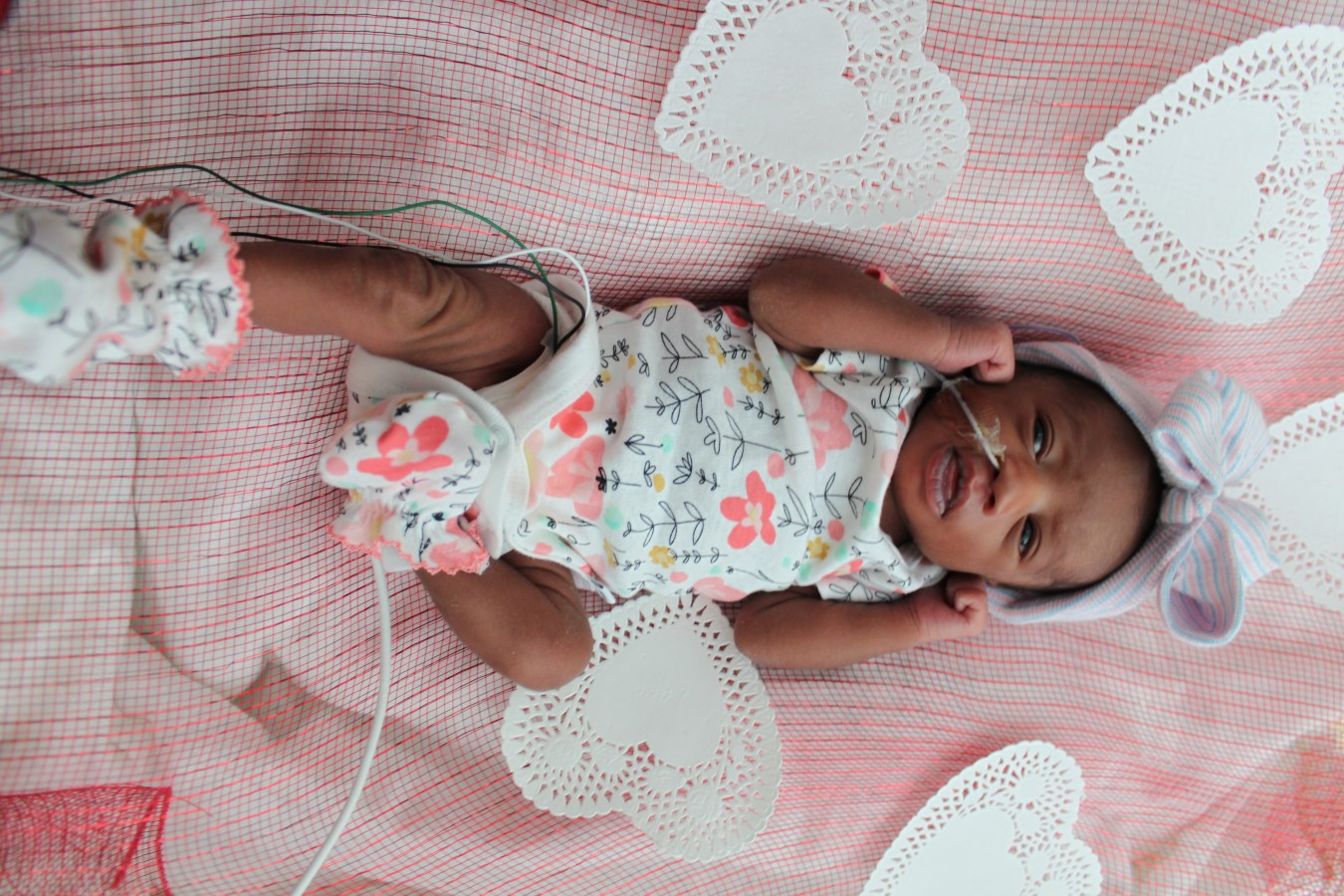 NICU babies' first Valentine's Day at Children’s Hospital Colorado, Colorado Springs