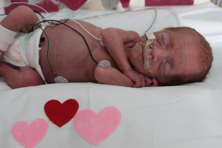 NICU babies' first Valentine's Day at Children’s Hospital Colorado, Colorado Springs